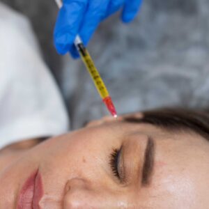 Platelet Rich Plasma
